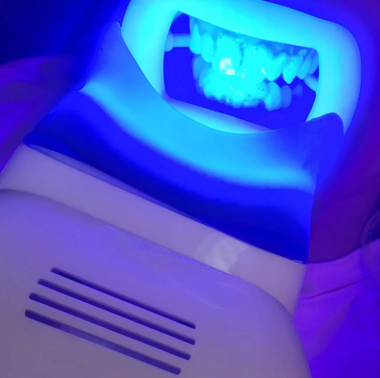 Vixens from Hell | Are Teeth Whitening Strips Dentist-Approved? LED Lights + Strips
