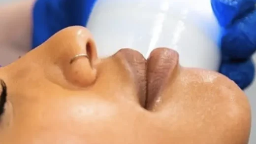 can cryotherapy help perimenopause symptoms