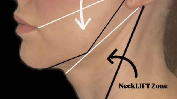 facial massage vs dermal fillers results